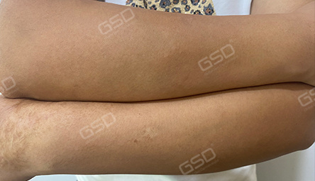 Диодный лазер COOLITE BOLT 1800W фото 11