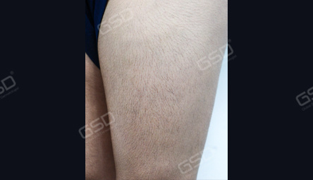 Диодный лазер COOLITE BOLT 1800W фото 6