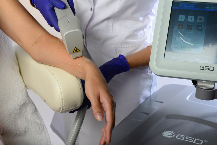 Оптоволоконный диодный лазер для эпиляции COOLITE PRO XL фото 10